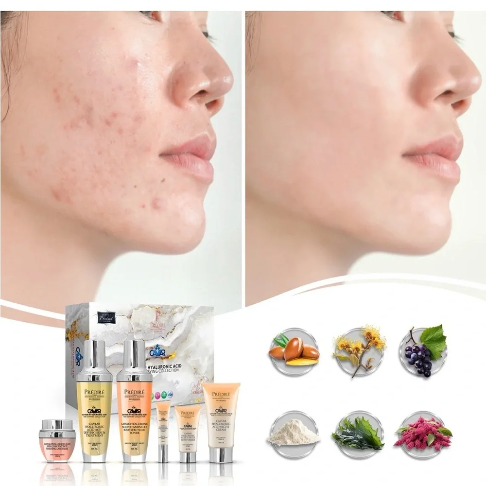 Prédiré Caviar Hyaluronic Face Set – Peach & Gold Moisturizer